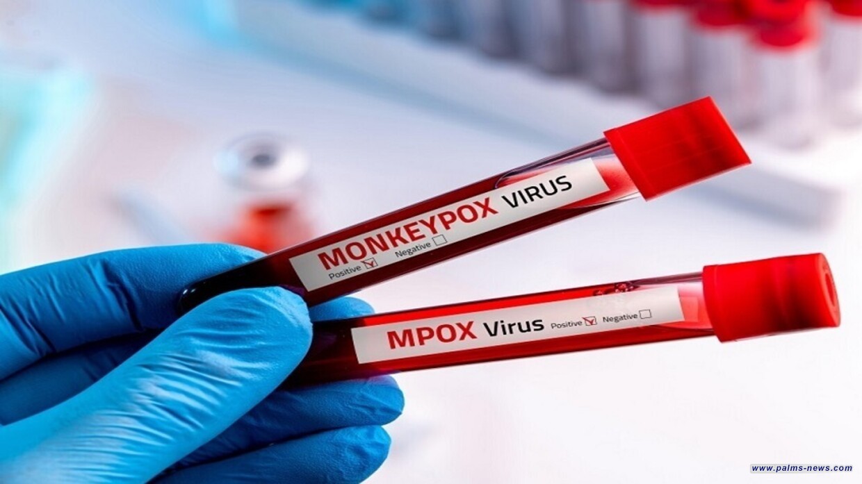 جدري القردة يتسلل إلى أكبر دولة سكانيا